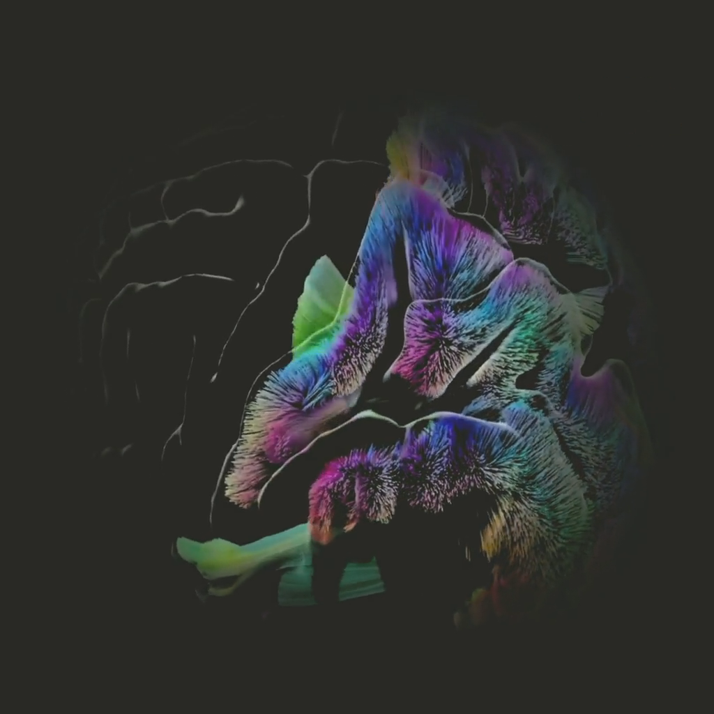 Visual system tractography.
